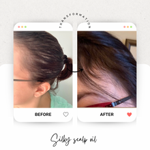 Load image into Gallery viewer, Growth Scalp Oil
